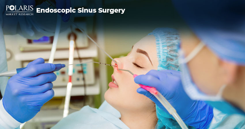 Everything you need to Know about Functional Endoscopic Sinus Surgery (FESS)